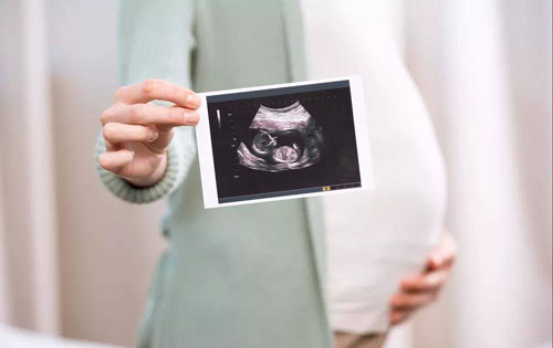 生育保險待遇調整的通知